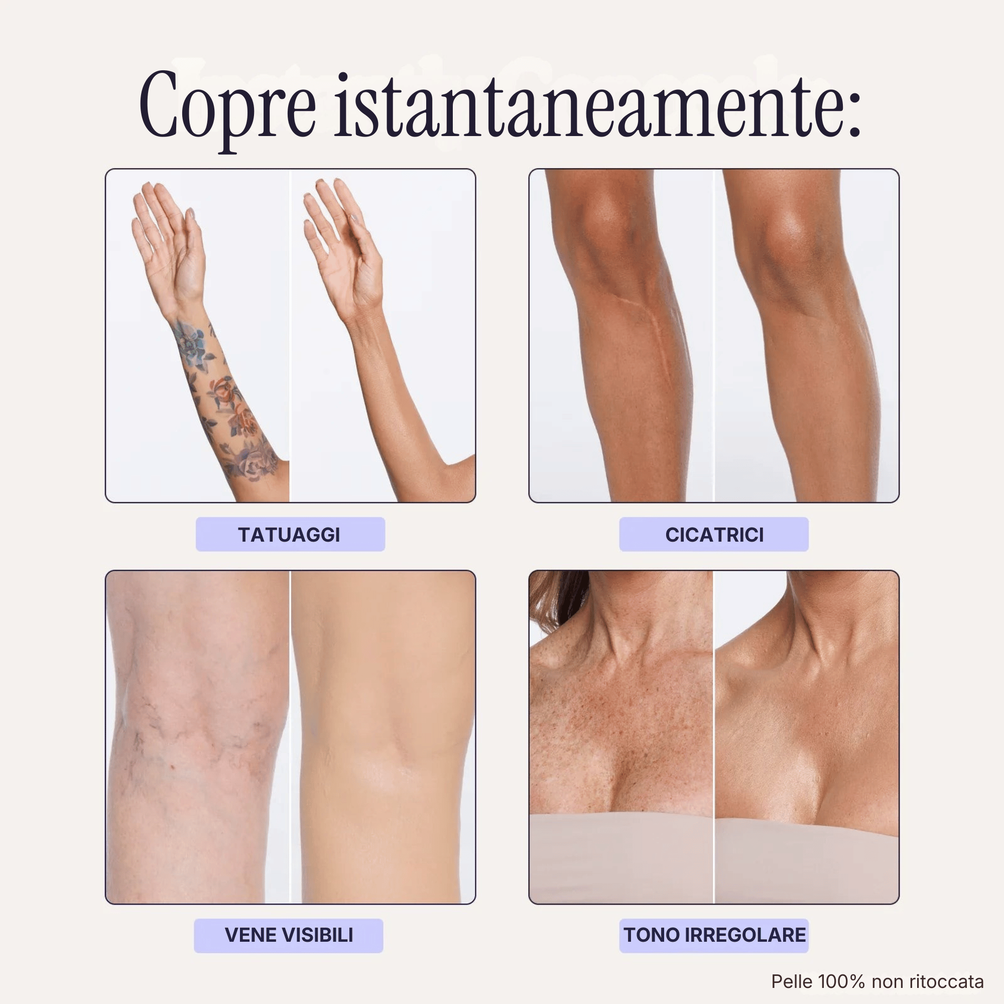 Coprente Pelle Perfetta