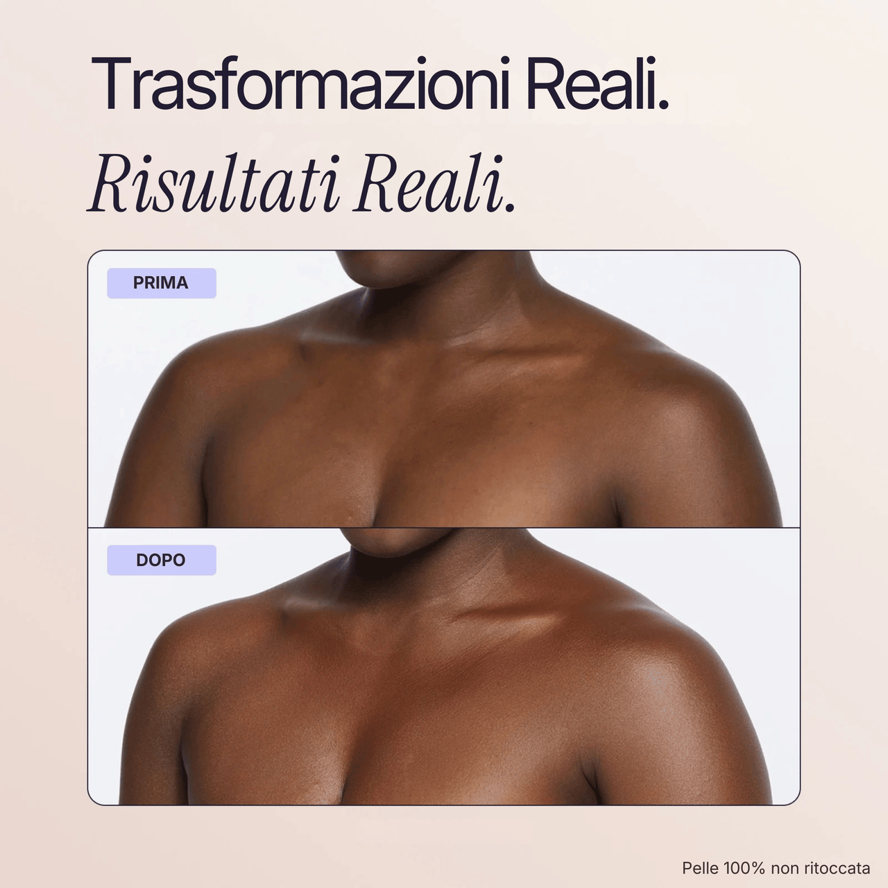 Coprente Pelle Perfetta