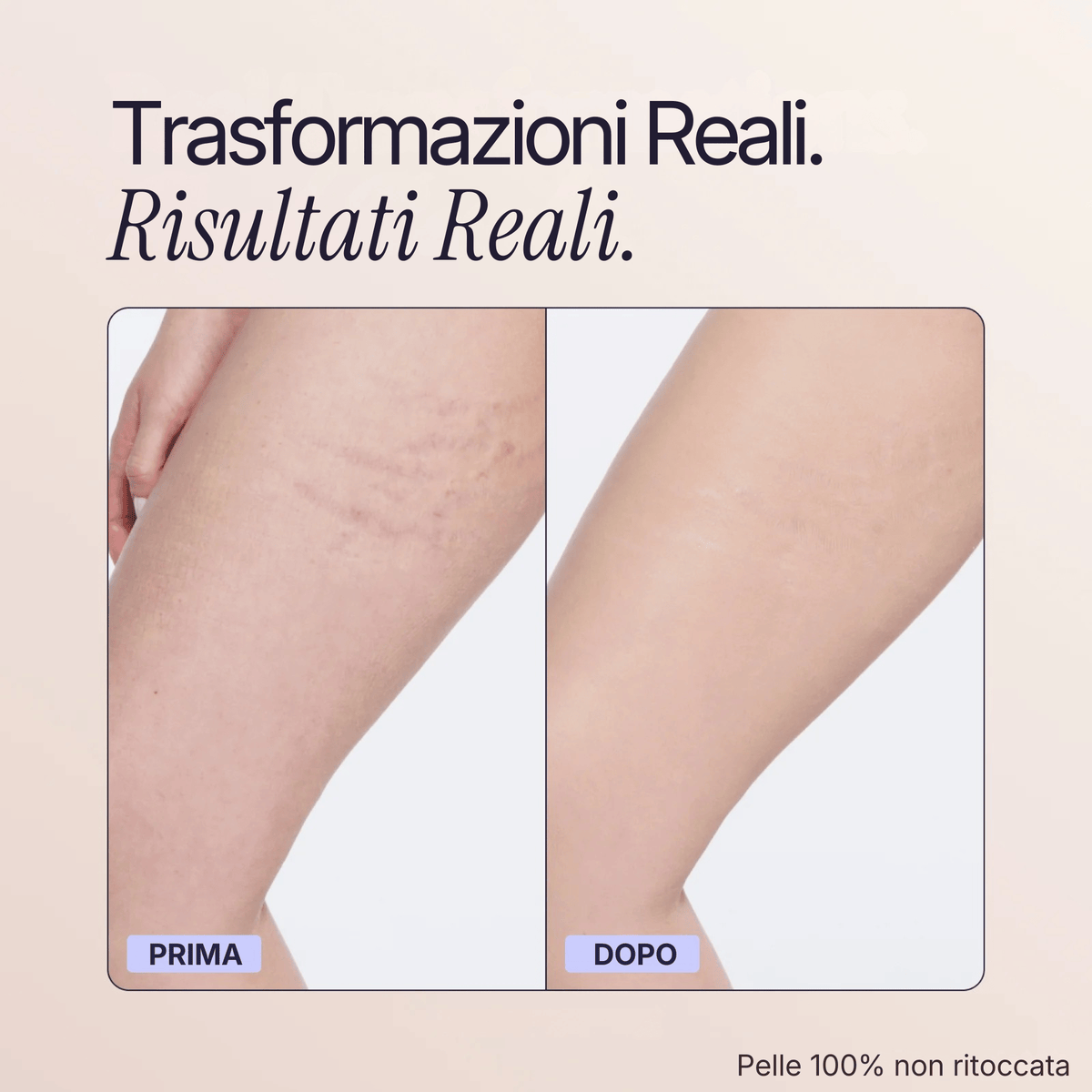 Body Coverage Perfector