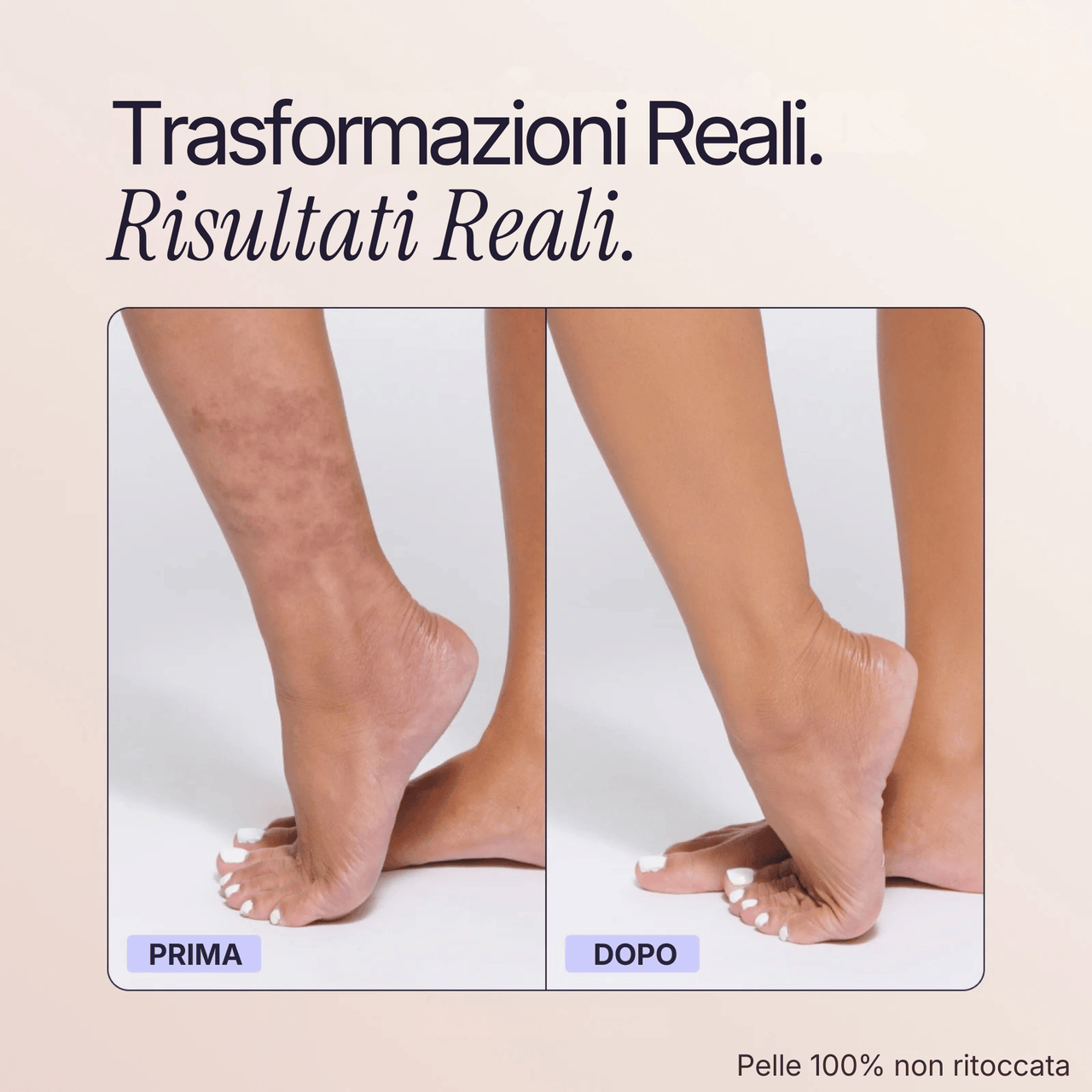 Coprente Pelle Perfetta