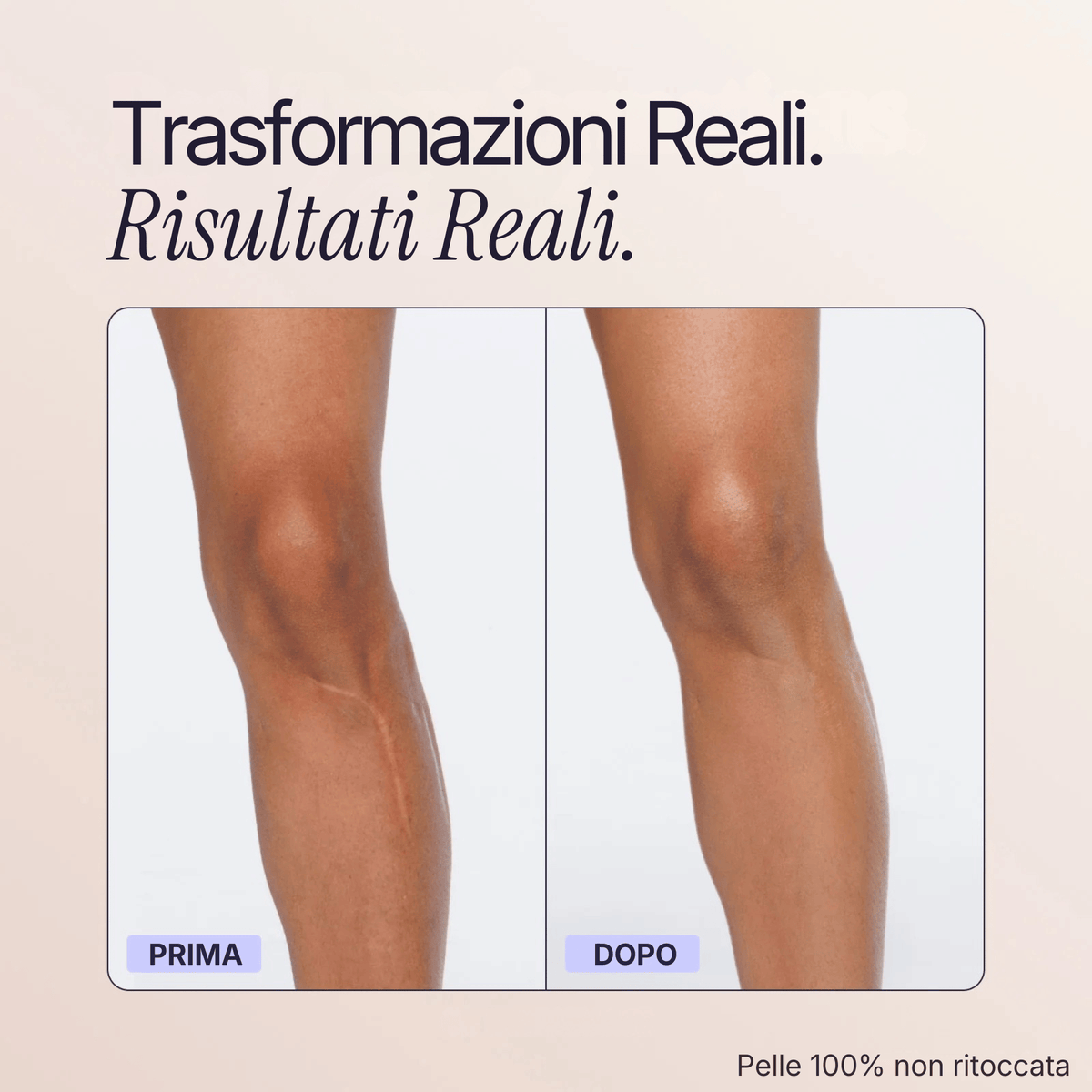 Body Coverage Perfector