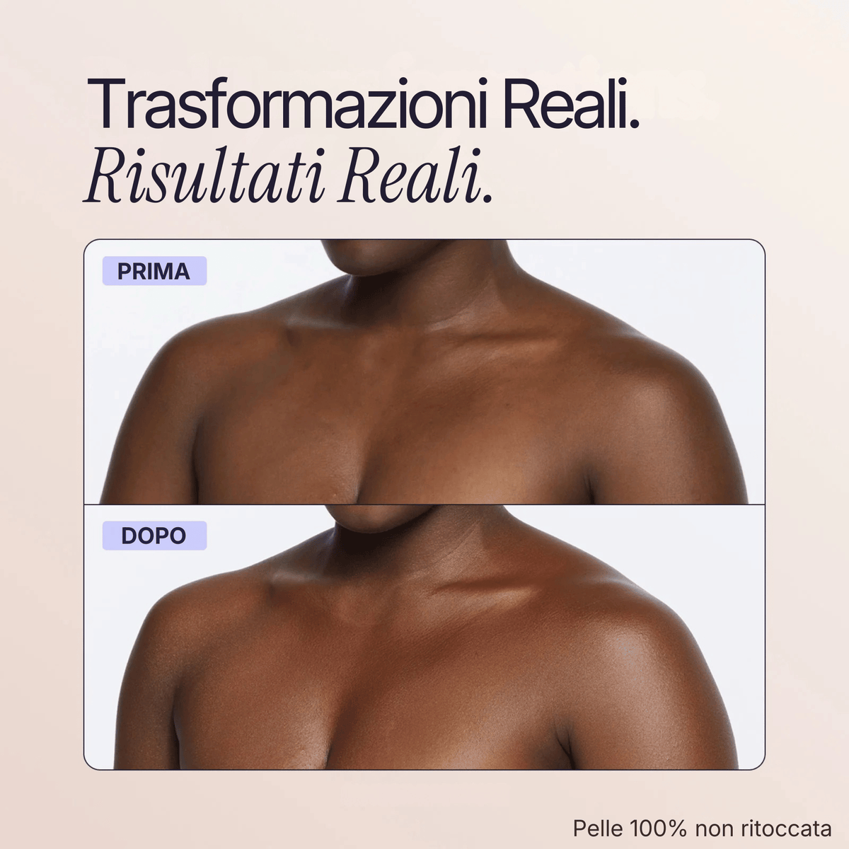Body Coverage Perfector