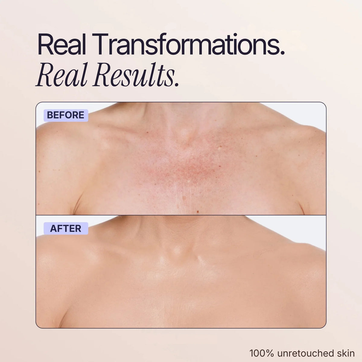 Body Coverage Perfector