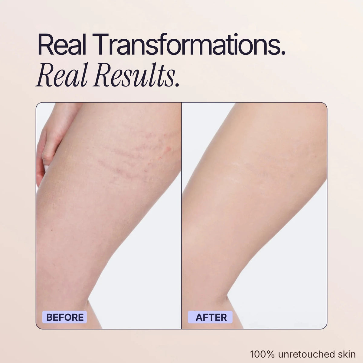 Body Coverage Perfector