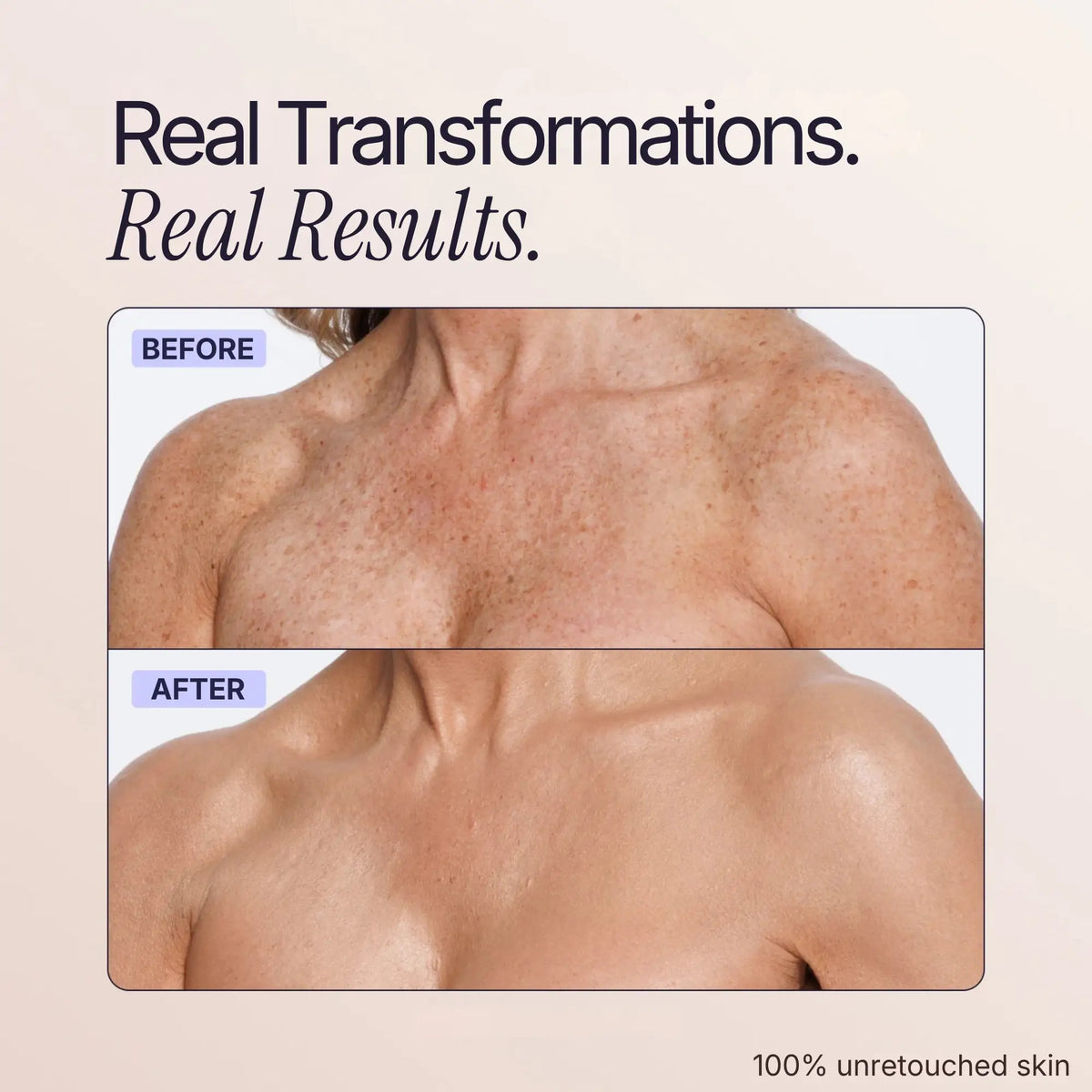 Body Coverage Perfector