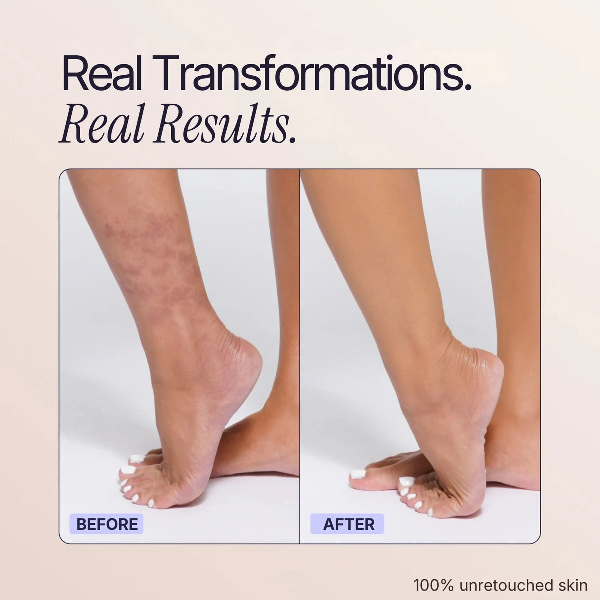 Body Coverage Perfector
