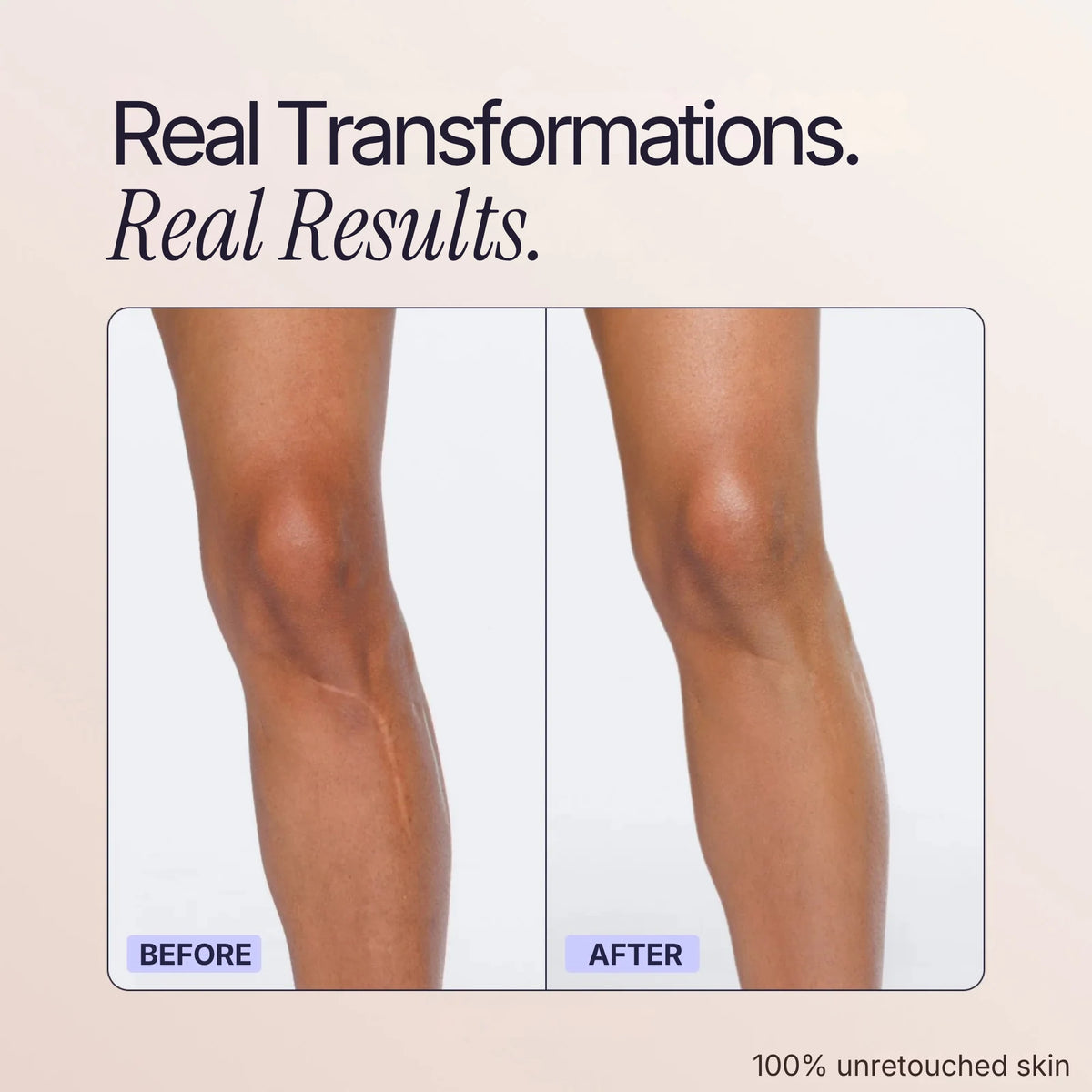 Body Coverage Perfector