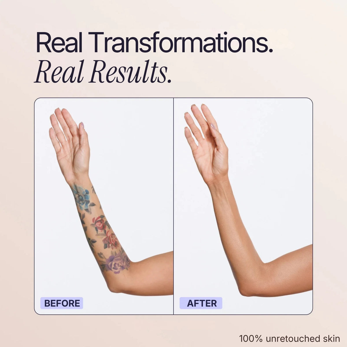 Body Coverage Perfector