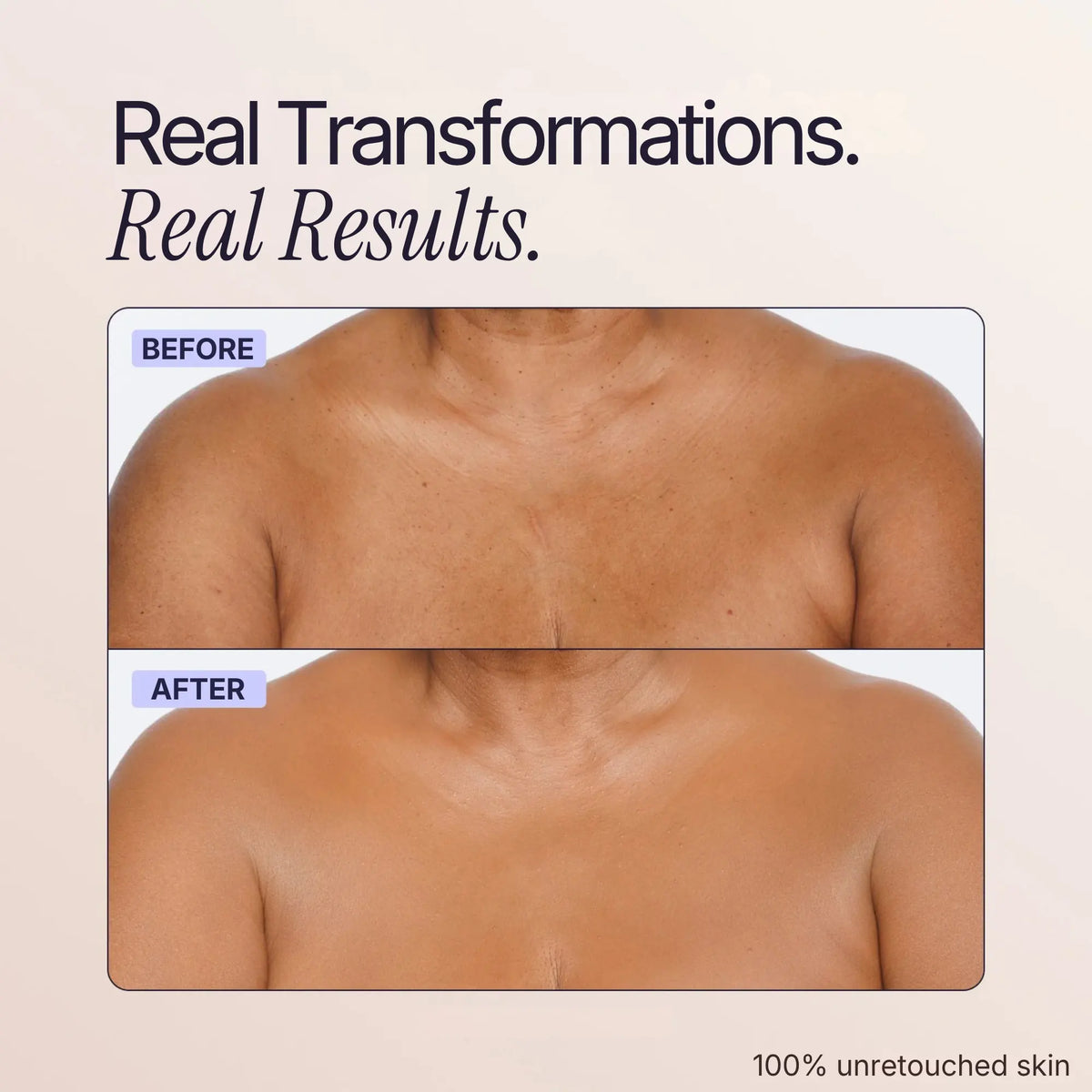 Body Coverage Perfector