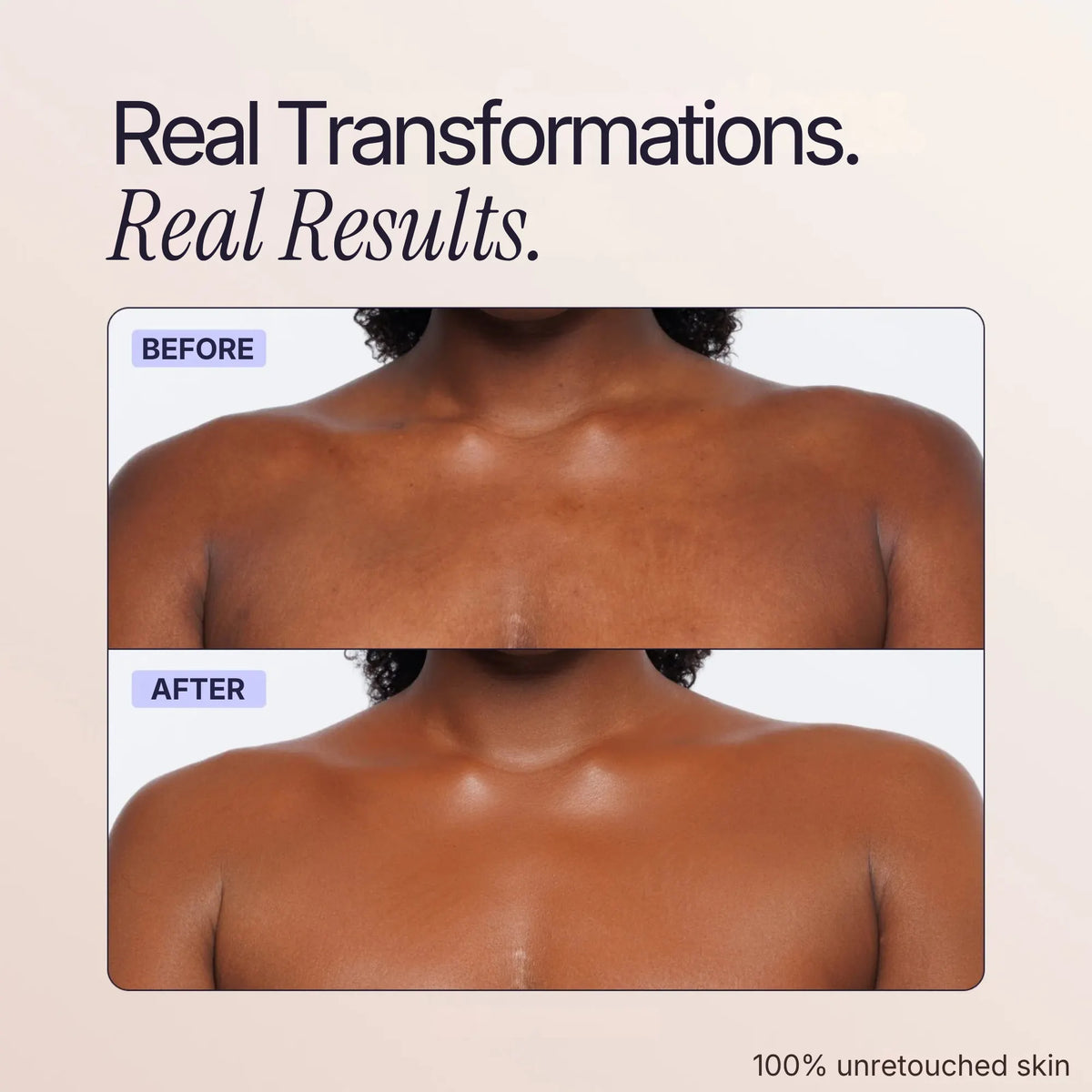 Body Coverage Perfector