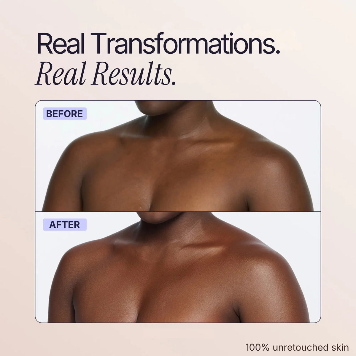 Body Coverage Perfector